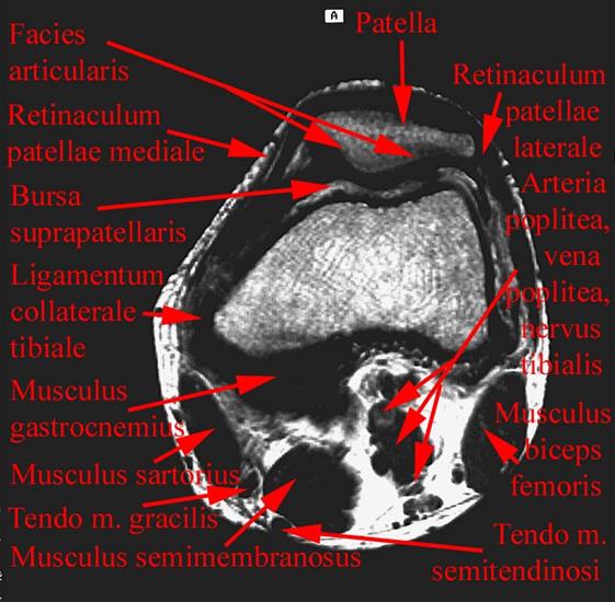 anatomia radiologiczna - 43.jpg